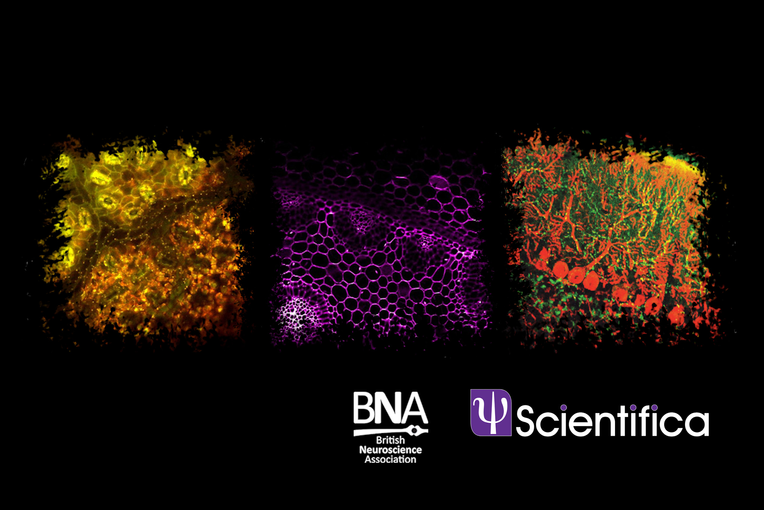 Multiphoton Imaging